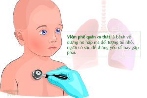 viêm phế quản phòng khám thuận kiều