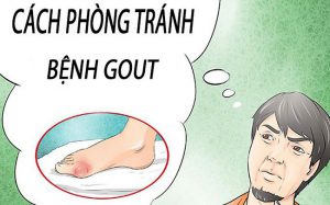 bệnh gout